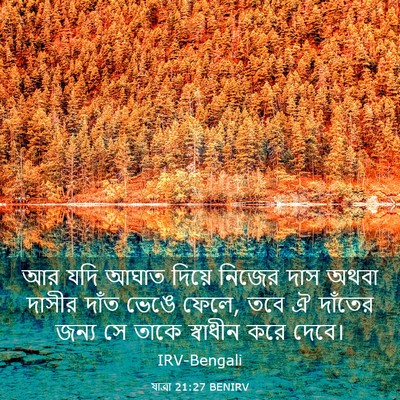Picture 03 - যাত্ৰা 21:27 BENIRV - আর যদি আঘাত দিয়ে - Bible Verse Picture