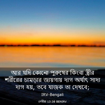 Picture 03 - লেবীয়া 13:38 BENIRV - আর যদি কোনো - Bible Verse Picture