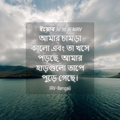 Picture 04 - ইয়োব 30:30 BENIRV - আমার চামড়া কালো - Bible Verse Picture