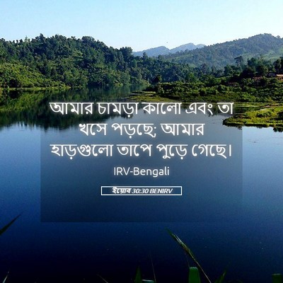 Picture 05 - ইয়োব 30:30 BENIRV - আমার চামড়া কালো - Bible Verse Picture