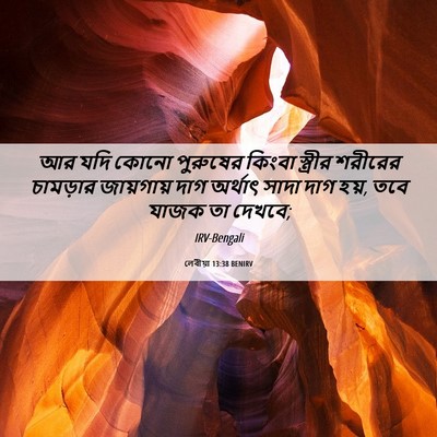 Picture 06 - লেবীয়া 13:38 BENIRV - আর যদি কোনো - Bible Verse Picture