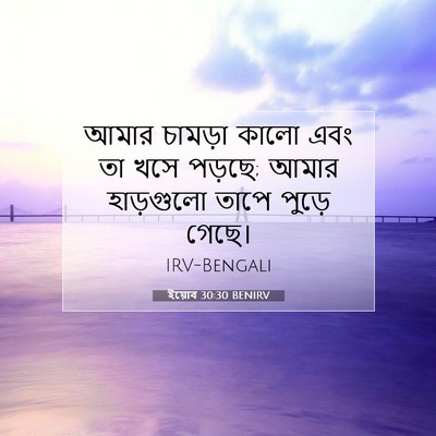 Picture 07 - ইয়োব 30:30 BENIRV - আমার চামড়া কালো - Bible Verse Picture