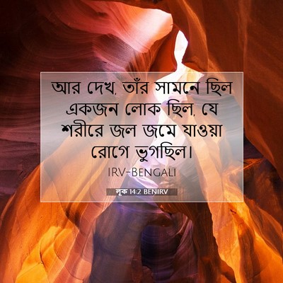 Picture 07 - লূক 14:2 BENIRV - আর দেখ, তাঁর সামনে - Bible Verse Picture