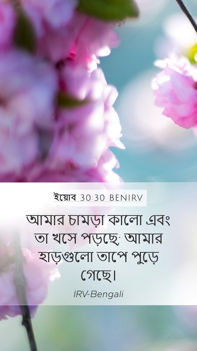 ইয়োব 30:30 BENIRV Bible Verse Image